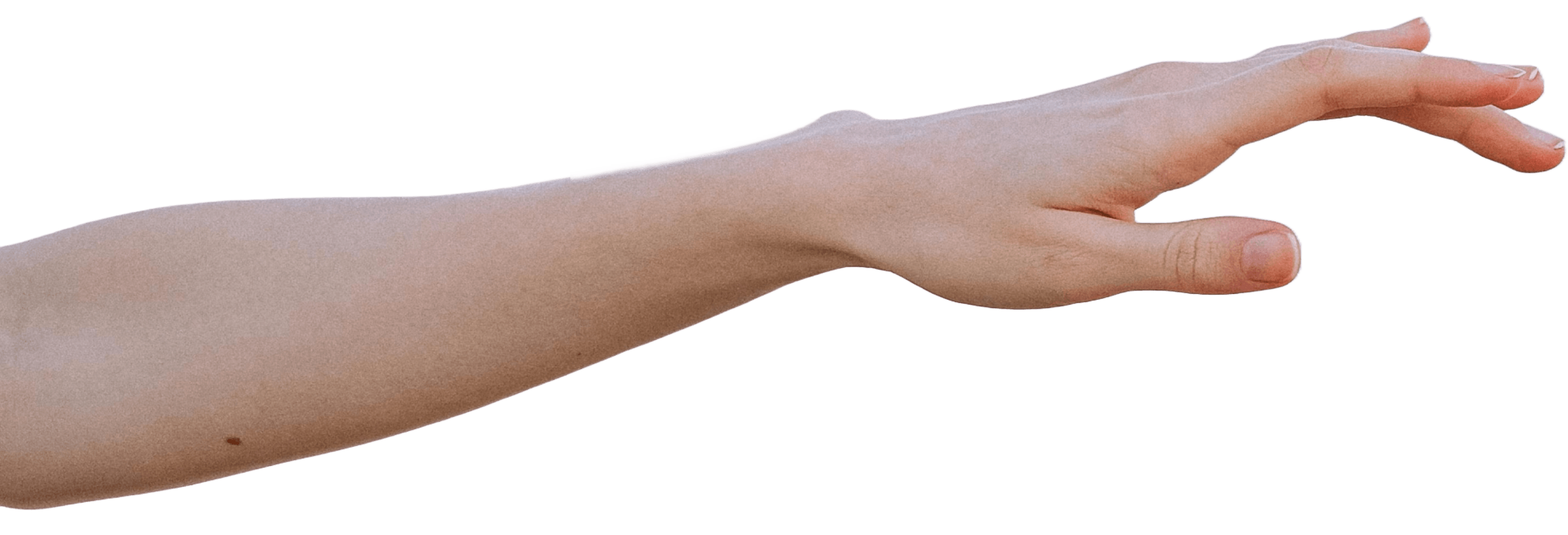 left arm